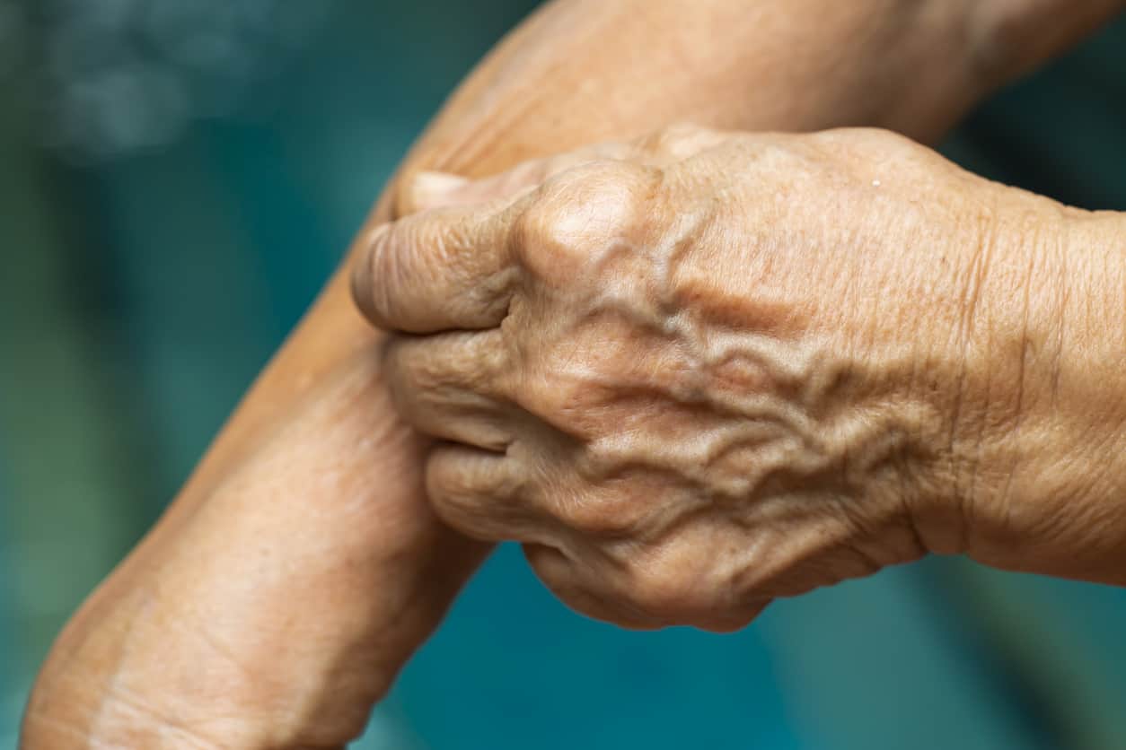 itchy skin ckd, kidney disease itchy skin, rash renal function, can CKD cause itchy skin, kidney disease and skin irritation, high potassium and ithcy skin