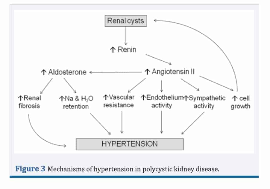 Hypertension and PKD