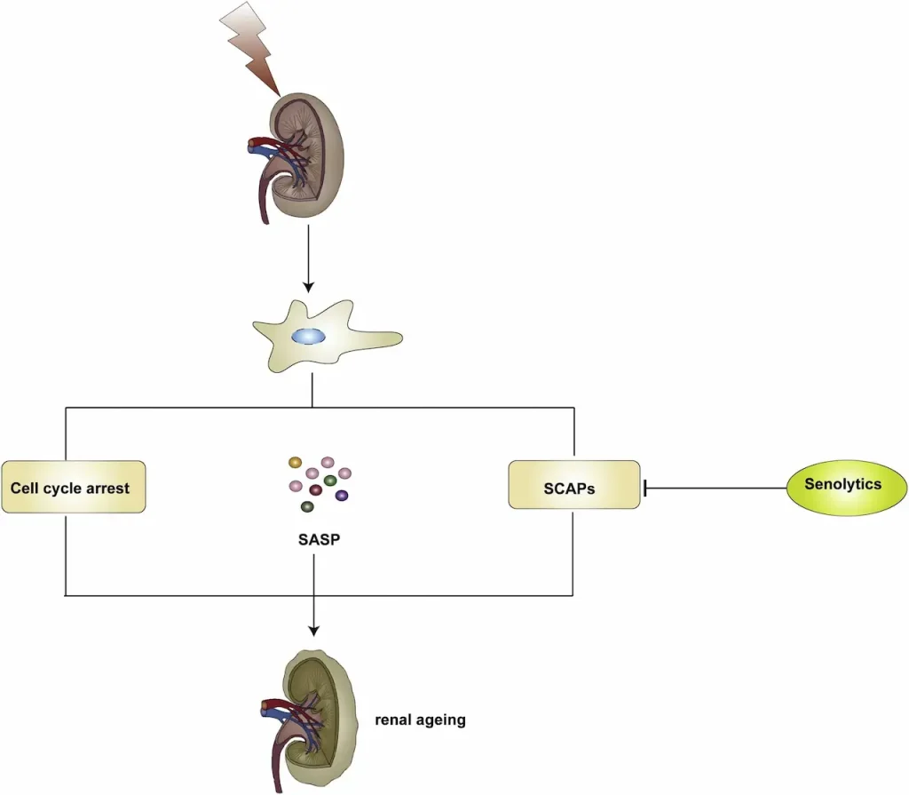 CKD Senescent Cells