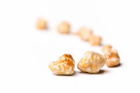 Everything You Need To Know About Kidney Stones