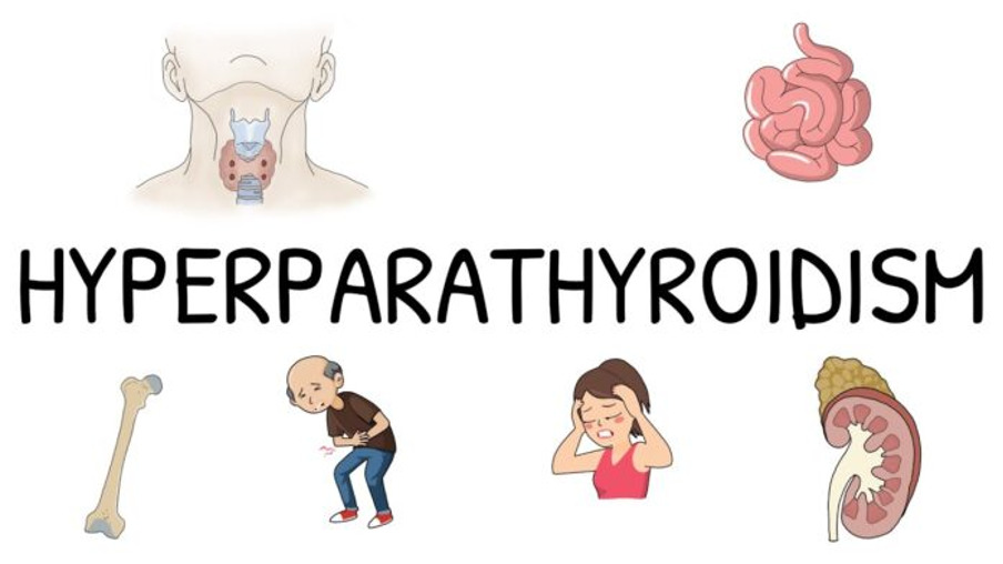 hyperparathyroidism and CKD