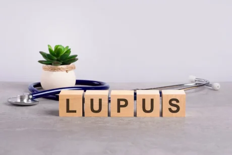 Lupus Nephritis and Kidney Disease