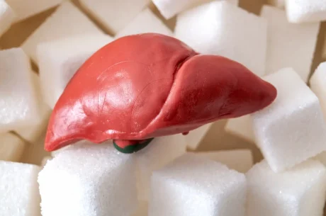 Non-Alcoholic Fatty Liver Disease & Renal Disease