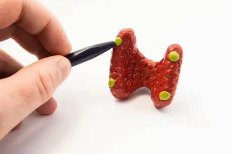 The Cause and Solutions for High Calcium in Your Bloodwork