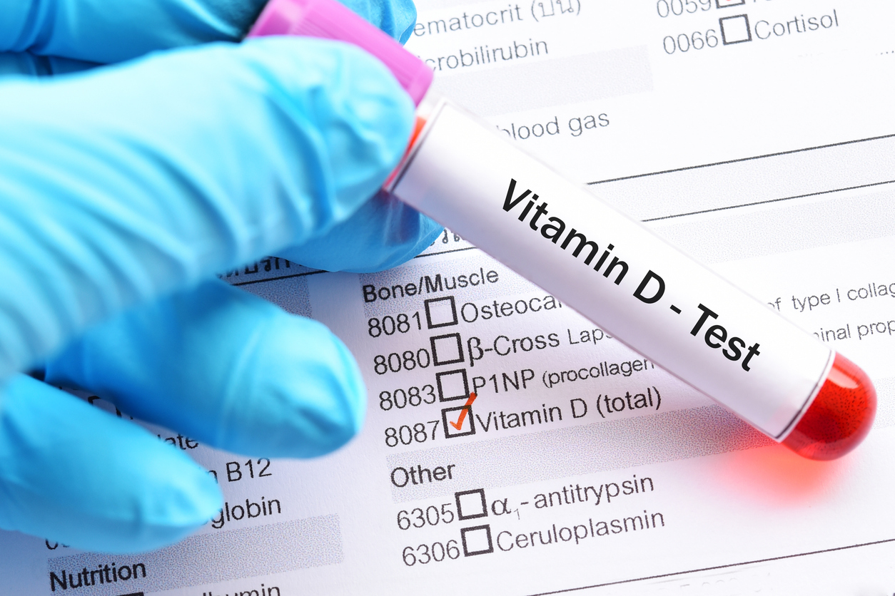 Vitamin D and kidney function