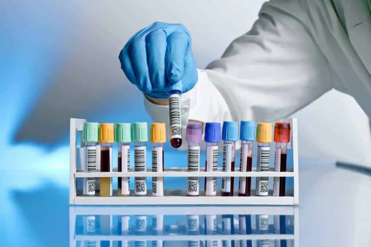 Blood Tests 