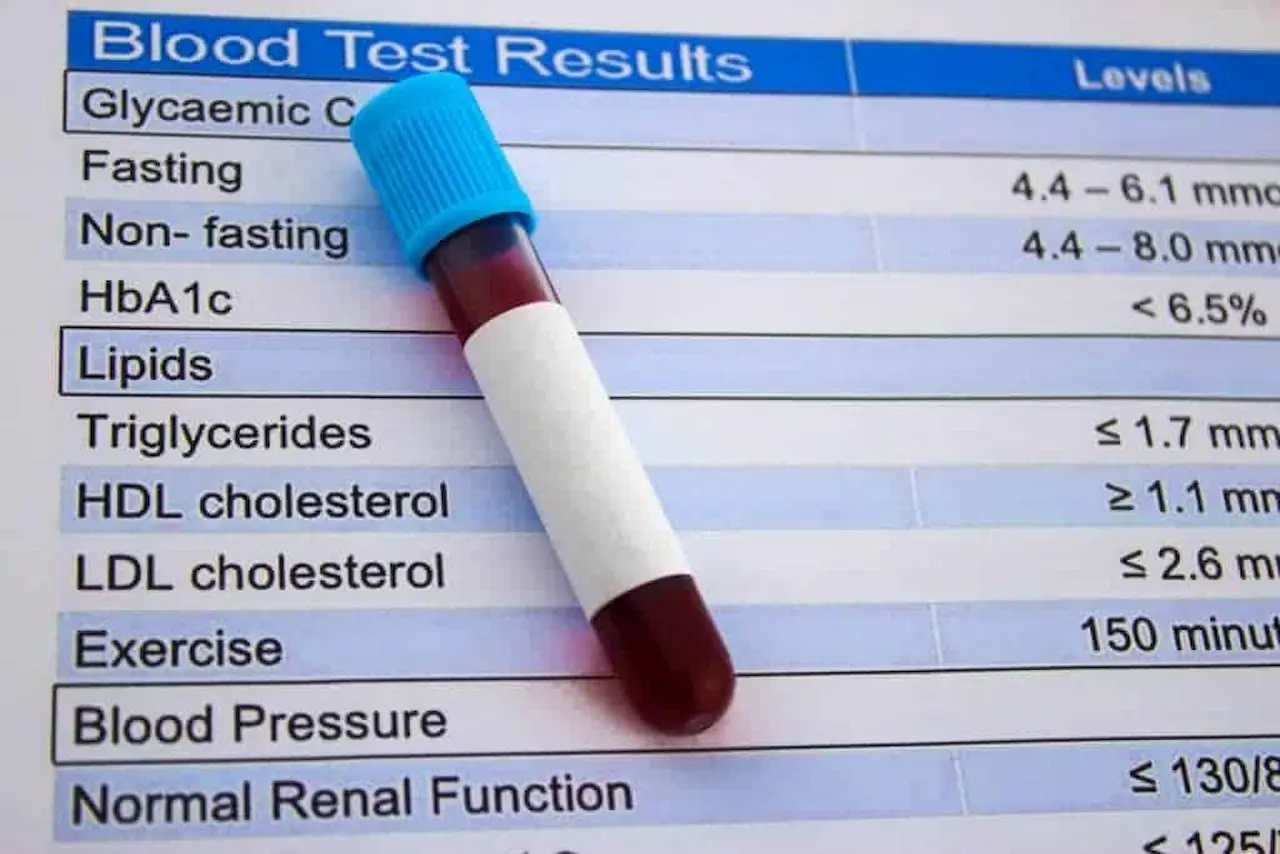 Blood Tests for Cholesterol 
