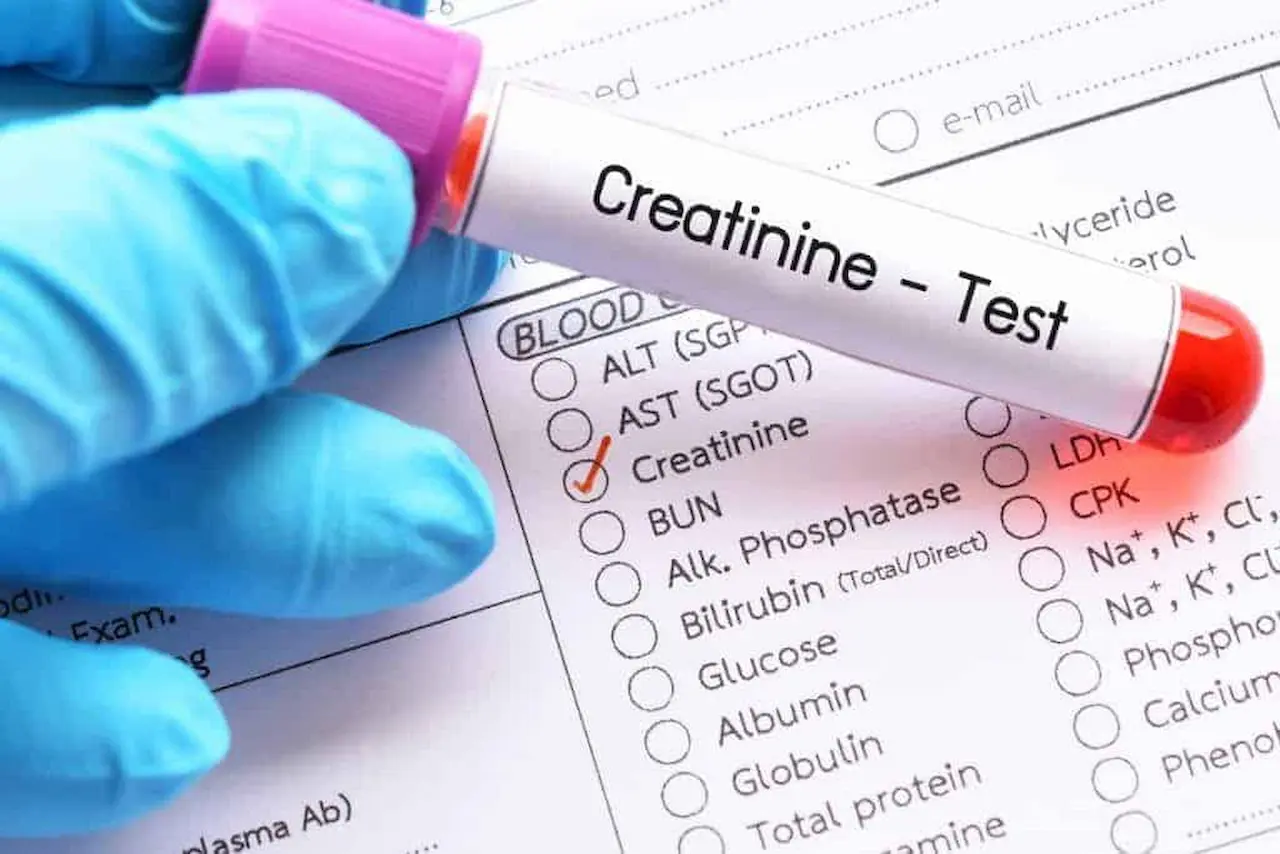 Creatinine Test 