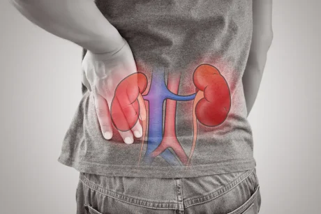 Kidney Disease Symptoms