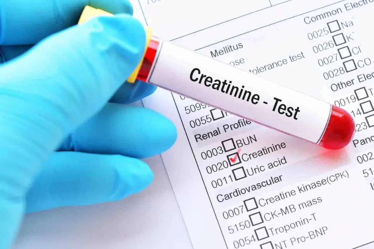 Lower Creatinine Levels Naturally