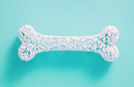 osteoporosis and kidney disease